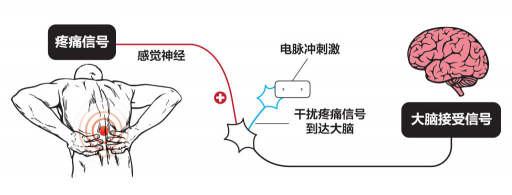 【ZE科普】一樣是電，為什么名字如此花哨