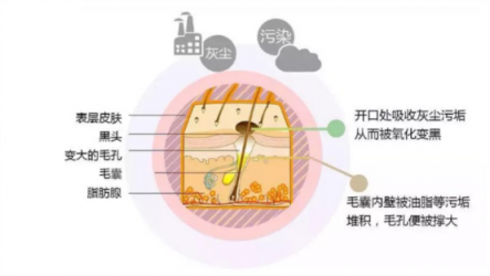 讓你的黑頭全退散！黑頭儀有用嗎？
