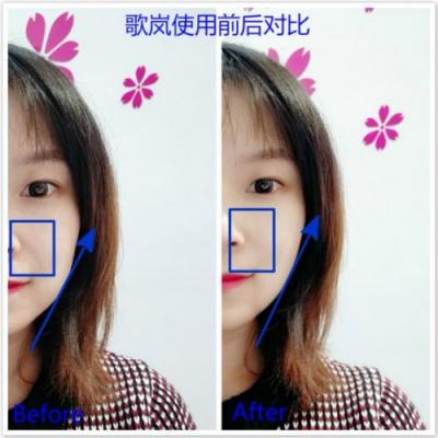 雅萌、GEVILAN歌嵐、Tripollar、NEWA美容儀到底選哪個(gè)？先評(píng)測(cè)一下再說(shuō)