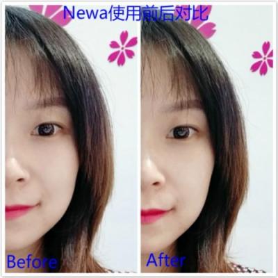 雅萌、GEVILAN歌嵐、Tripollar、NEWA美容儀到底選哪個(gè)？先評(píng)測(cè)一下再說(shuō)