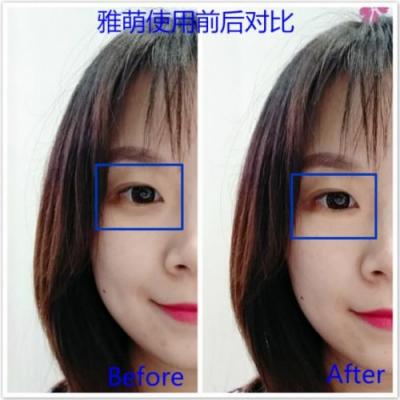 雅萌、GEVILAN歌嵐、Tripollar、NEWA美容儀到底選哪個(gè)？先評(píng)測(cè)一下再說(shuō)